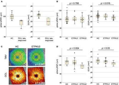 Optical Coherence Tomography to Assess Neurodegeneration in Phenylalanine Hydroxylase Deficiency